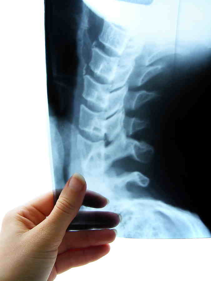 Stryker Strengthens Its Spinal Division with K2M Deal